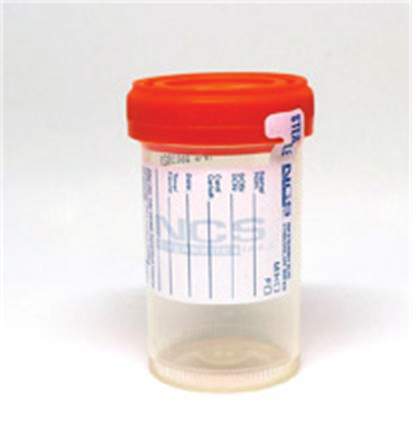 Starplex Sterile Specimen Container 90 mL